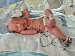 A baby lays face up in an incubator.