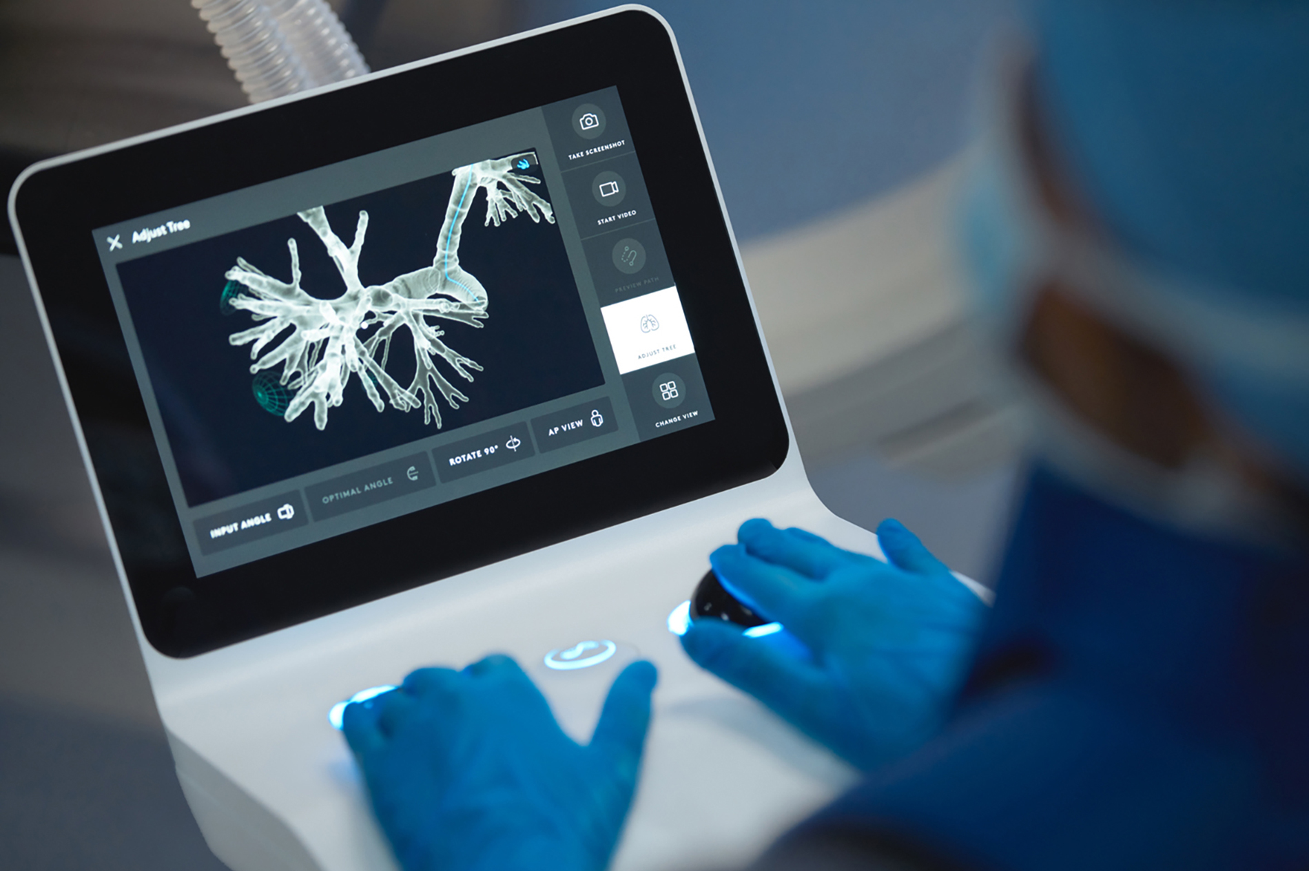 Ion controller with image of lung on screen