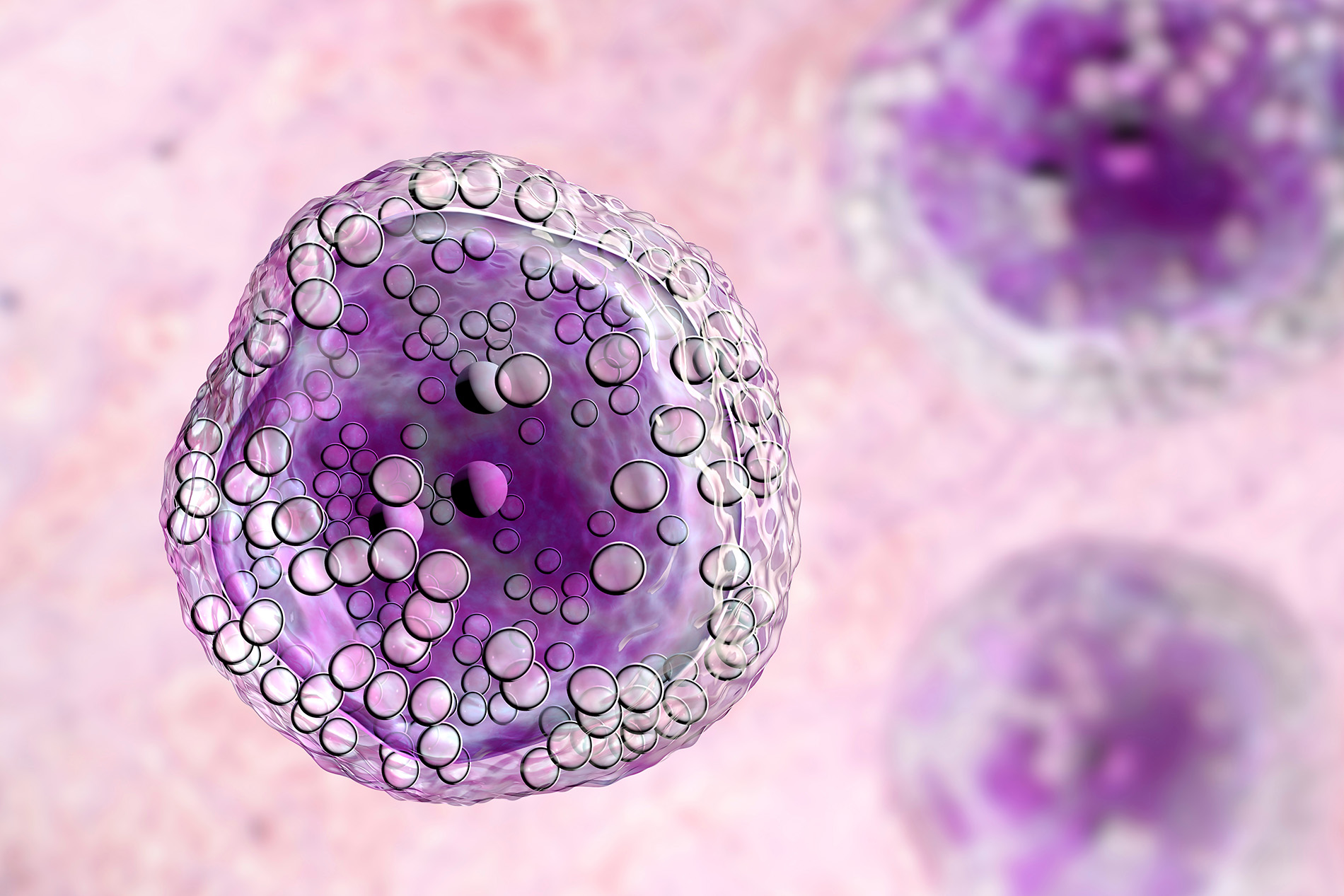 Microscopic image of lymphoma cells