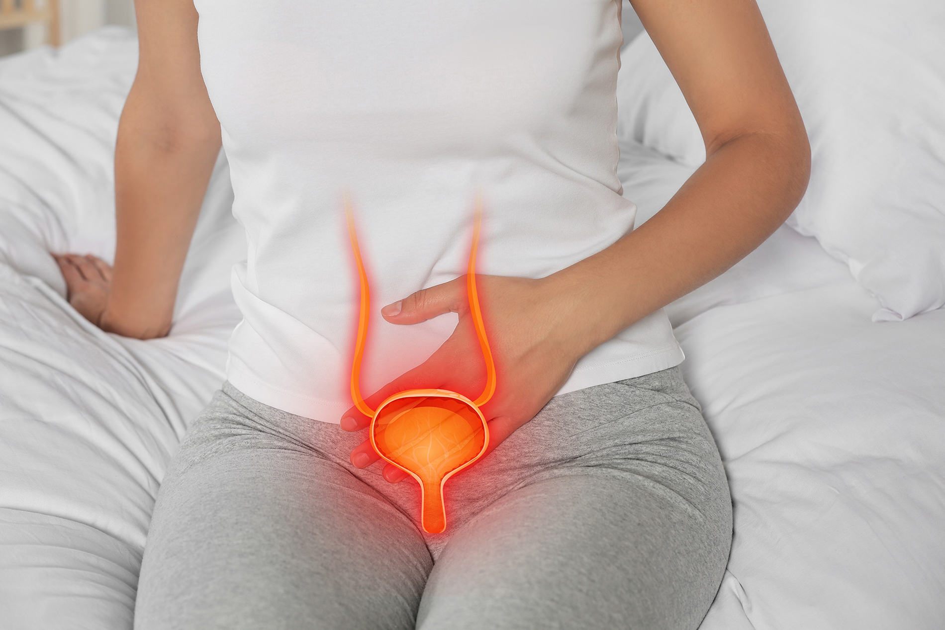 Woman sitting on bed touching her lower abdomen with overlay of medical illustration of urinary tract in red on her abdomen