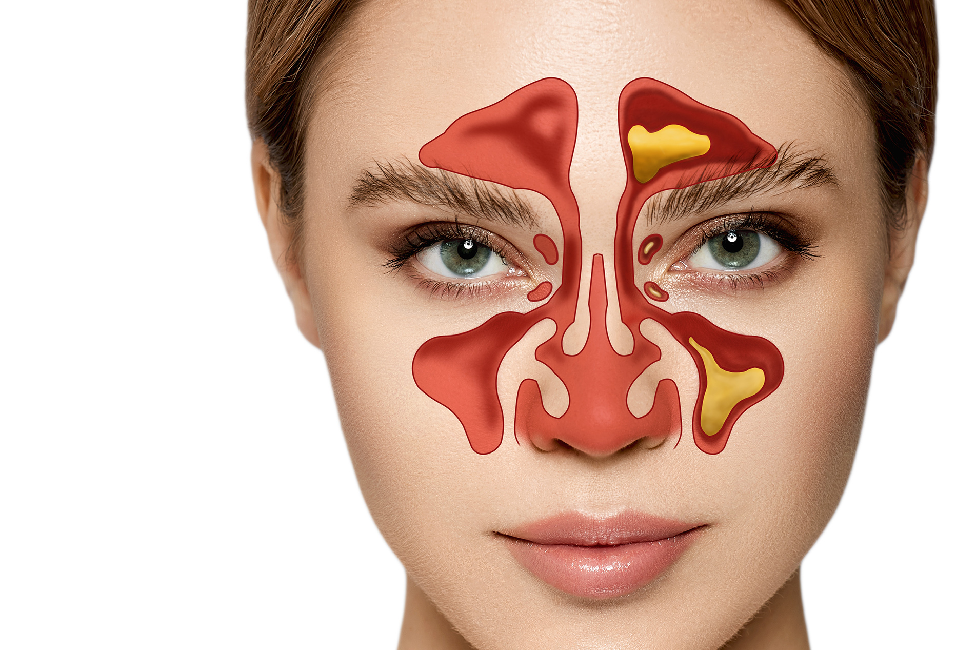 Photo of beautiful woman with medical illustration of her sinus cavities