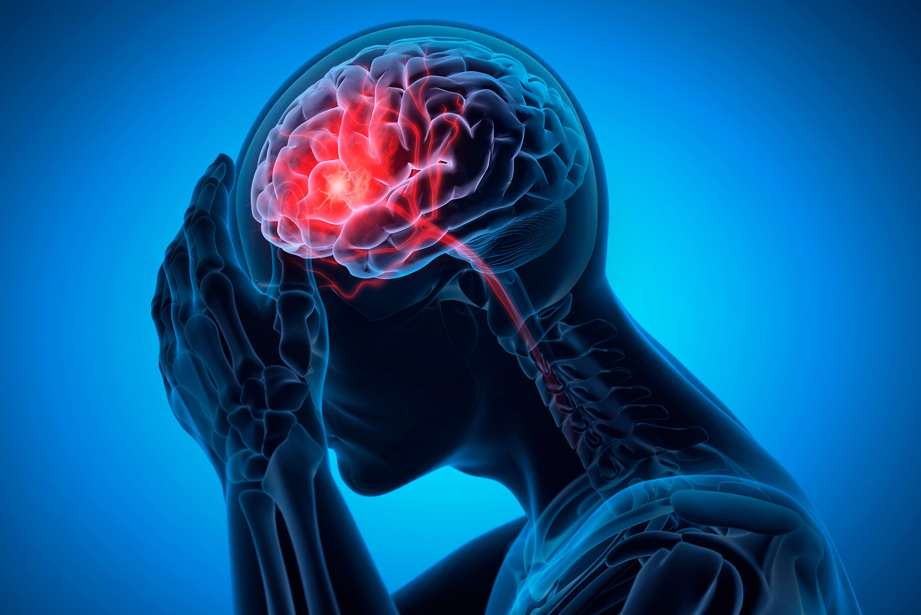 Abstract blue illustration of man's brain with a stroke illuminated in red