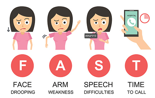 Illustration of stroke symptoms