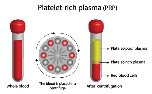 Medical illustration of whole  blood centrifuged into it's components